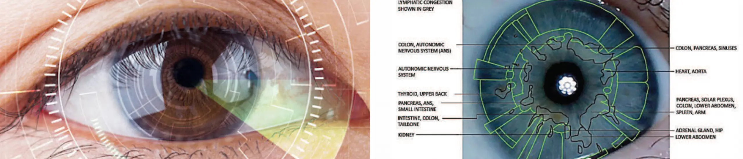 Close-up iris analysis diagram used to explain iridology concepts in holistic nutrition studies