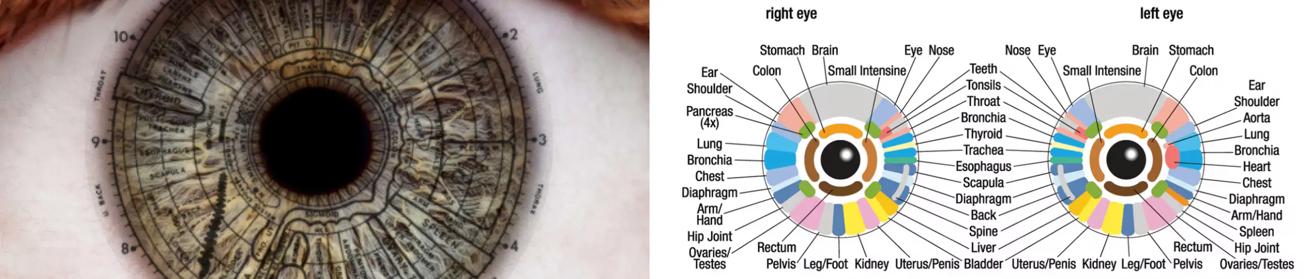 Detailed iridology eye map showing traditional iris assessment reference zones